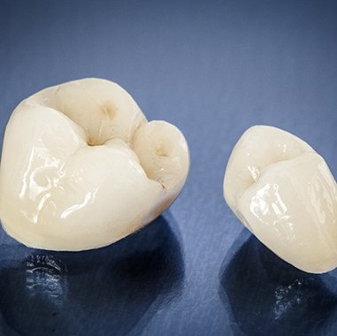 customized dental crowns sitting next to each other on a countertop