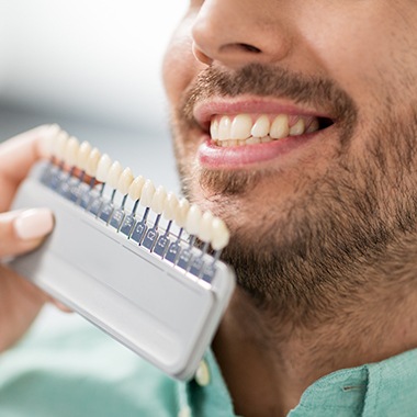 Man's smile compared with porcelain veneer shade chart