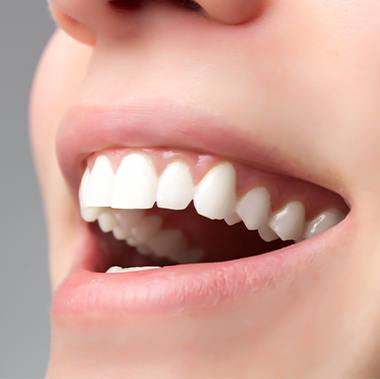 Closeup of smile after metal free dental restoration