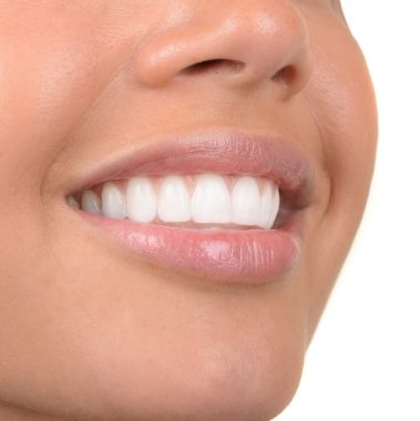 Closeup of flawless smile after dental implant tooth replacement