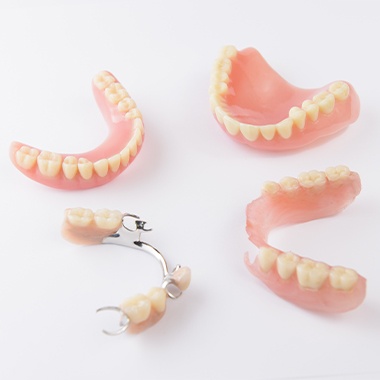 Four types of dentures