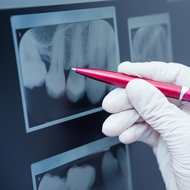 Pen pointing at digital dental x-rays